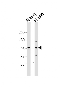 (Mouse) Med15 Antibody (C-term)