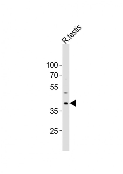 PCGF6 Antibody (Center)