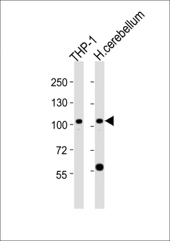 ZFPM1 Antibody (C-term)