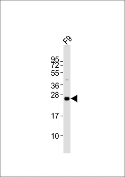 (Mouse) Lin28a Antibody (C-term)