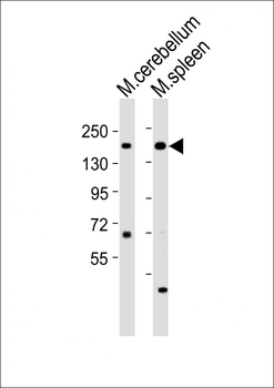 Mouse Kdm6a Antibody (C-term)