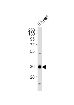 Mouse Nkx2-5 Antibody (Center)