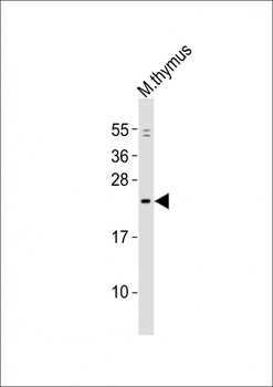 Mouse Gins1 Antibody (C-term)