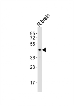 LHX5 Antibody (Center)