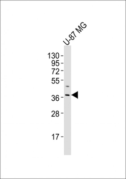 OR4K17 Antibody (Center)
