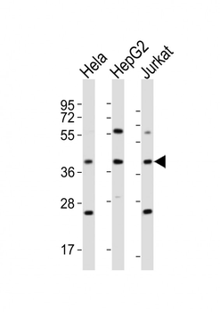 OR5M9 Antibody (C-term)