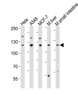 ZNF281 Antibody (Center)