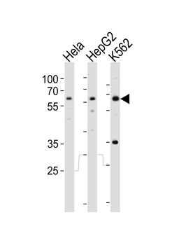 RIOK3 Antibody (Center)