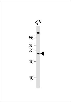 (Mouse) Cldn6 Antibody (C-term)