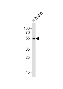 PIP4K2A Antibody (C-term)
