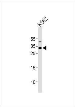 TAL1 Antibody (C-term)