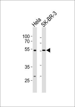 SMARCE1 Antibody (C-term)
