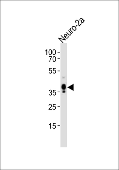 (Mouse) Msi1 Antibody (Center)