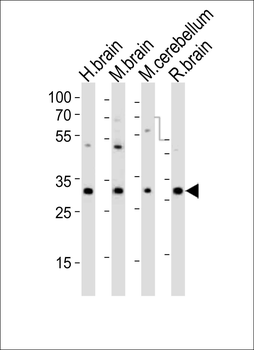 PCGF1 Antibody (Center)