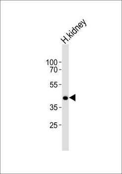 PCGF6 Antibody (C-term)