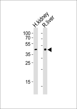(Mouse) Ihh Antibody (C-term)