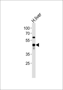 SERPINE1 Antibody (C-term)