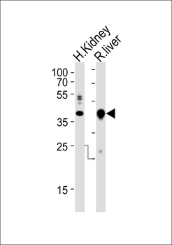 (Mouse) Ihh Antibody (C-term)