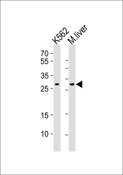 CYB5R2 Antibody (N-term)