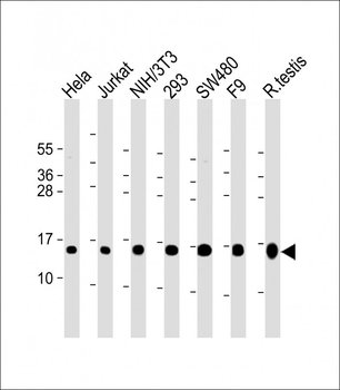 UBE2D2 Antibody (N-term)