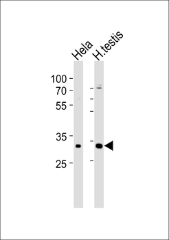 MTX2 Antibody (Center)