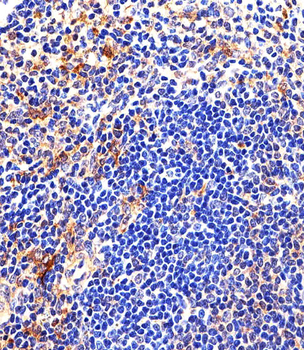Mouse Lyn Antibody (Center)