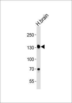 ZNF423 Antibody (Center)