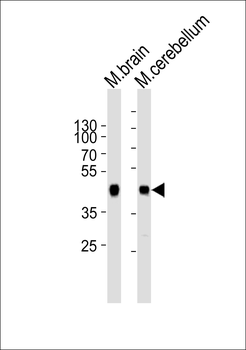 ZDHHC14 Antibody (Center)