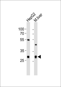 CTDSP1 Antibody (N-term)