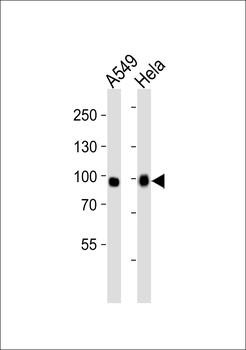 Mouse Fgfr3 Antibody (Center)