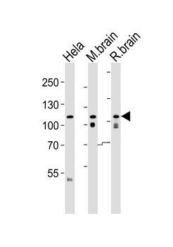 OPA1(form S1) Antibody (C-term)