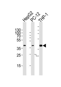 MAPK13/14 Antibody (Center)