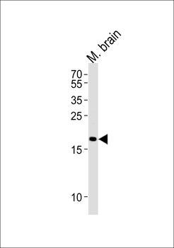 CPLX2 Antibody (Center)