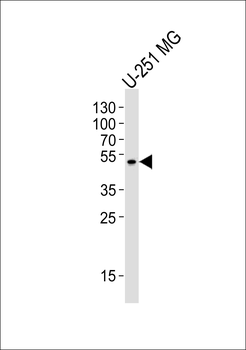 ZNF830 Antibody (Center)
