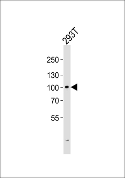 GIT2 Antibody (C-term)