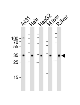 CYB5R3 Antibody (Center)
