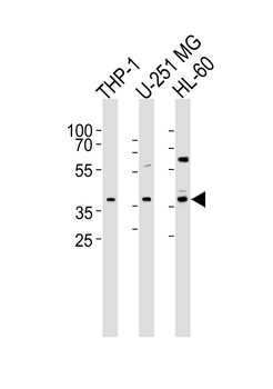 RAD9B Antibody (C-term)