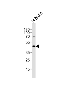 HTR1A Antibody (Center)