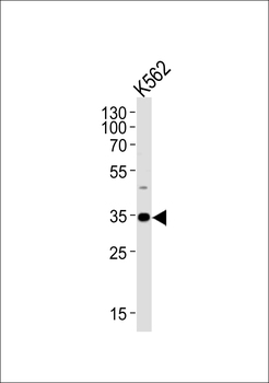 BBS5 Antibody (Center)