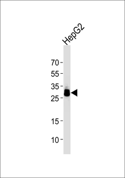 PPT1 Antibody (C-term)