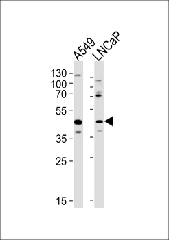 GGN Antibody (Center)