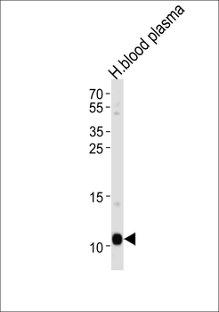 APOA2 Antibody (Center)
