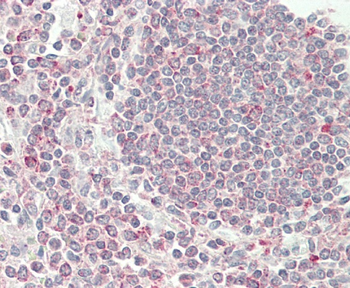 VAMP8 Antibody (N-term)