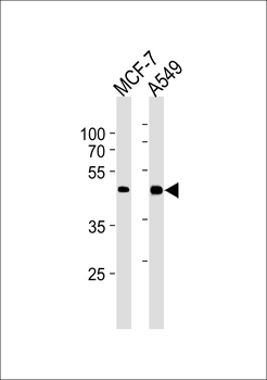 CCRK Antibody (N-term)
