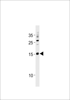SSNA1 Antibody (N-term)