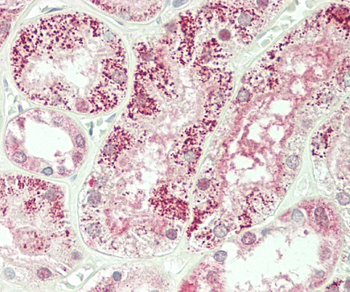 PKP4 Antibody (C-term)