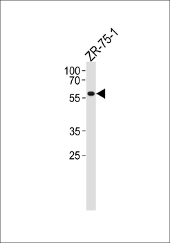 PPP2R2A Antibody (N-term)