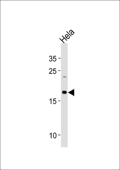 NDUFB10 Antibody (Center)