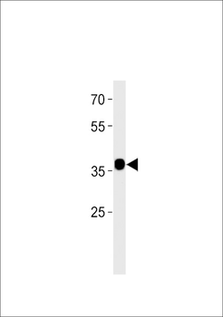 MAIP1 Antibody (C-term)