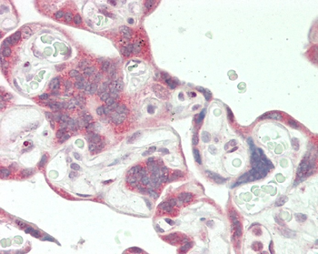 MORC3 Antibody (Center)